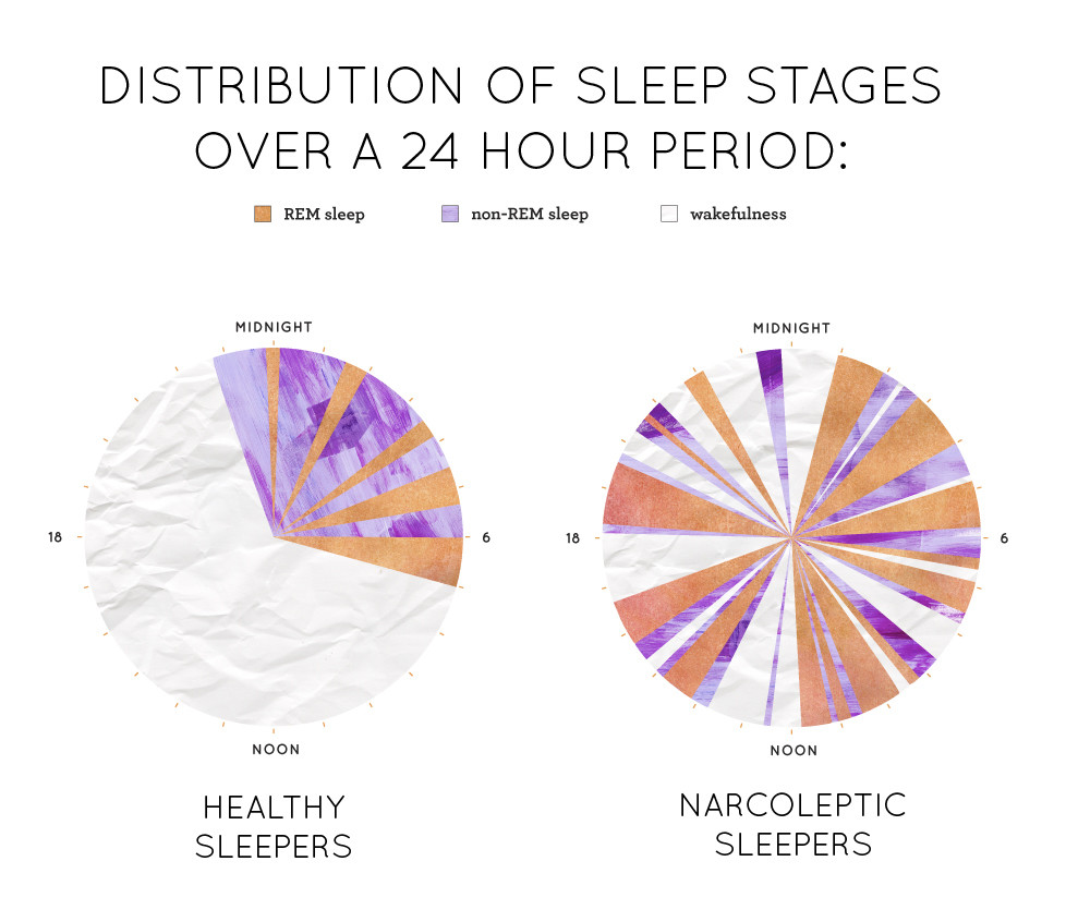 falling asleep narcolepsy infographic