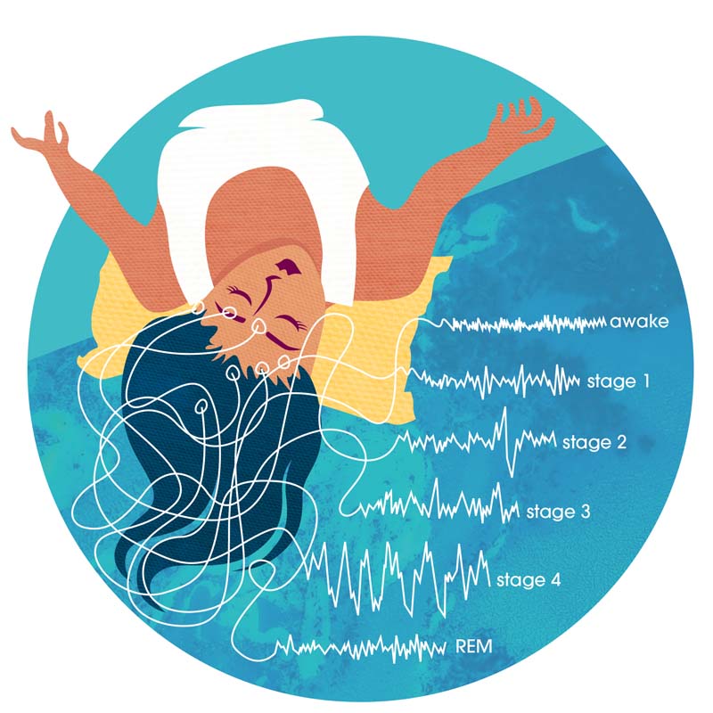 narcolepsy illustration sleep stages study brain waves REM